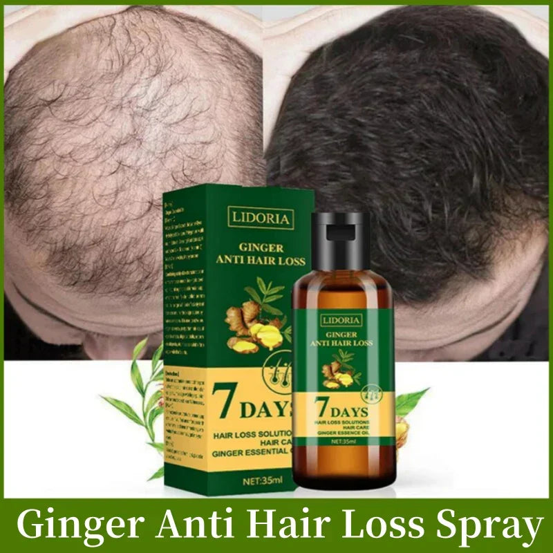 Ginger Hair Growth Product Anti-Loss Hair Regrowth Serum