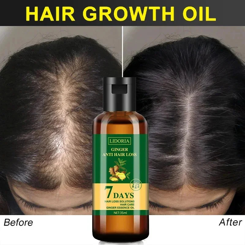 Ginger Hair Growth Essential Oil Anti-Loss Hair Regrowth