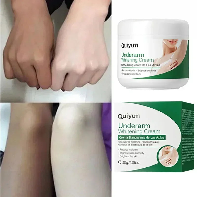 Effective Improve Body Whitening Cream Armpit Legs Knee