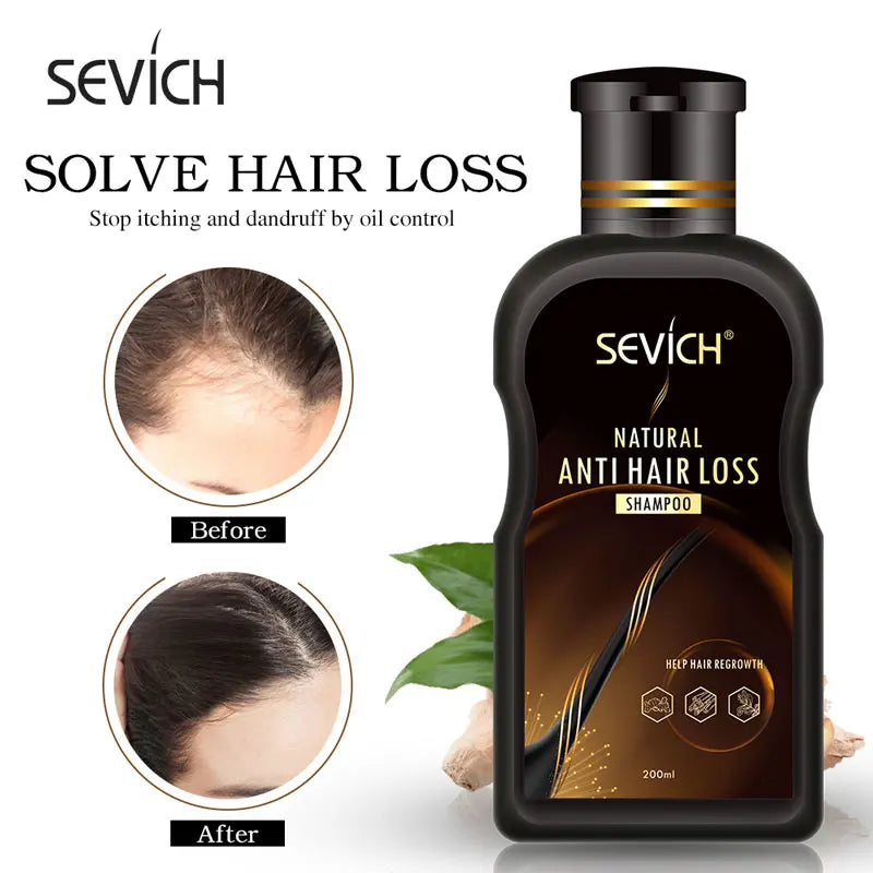 Sevich Anti Hair Loss Product Hair Loss Shampoo