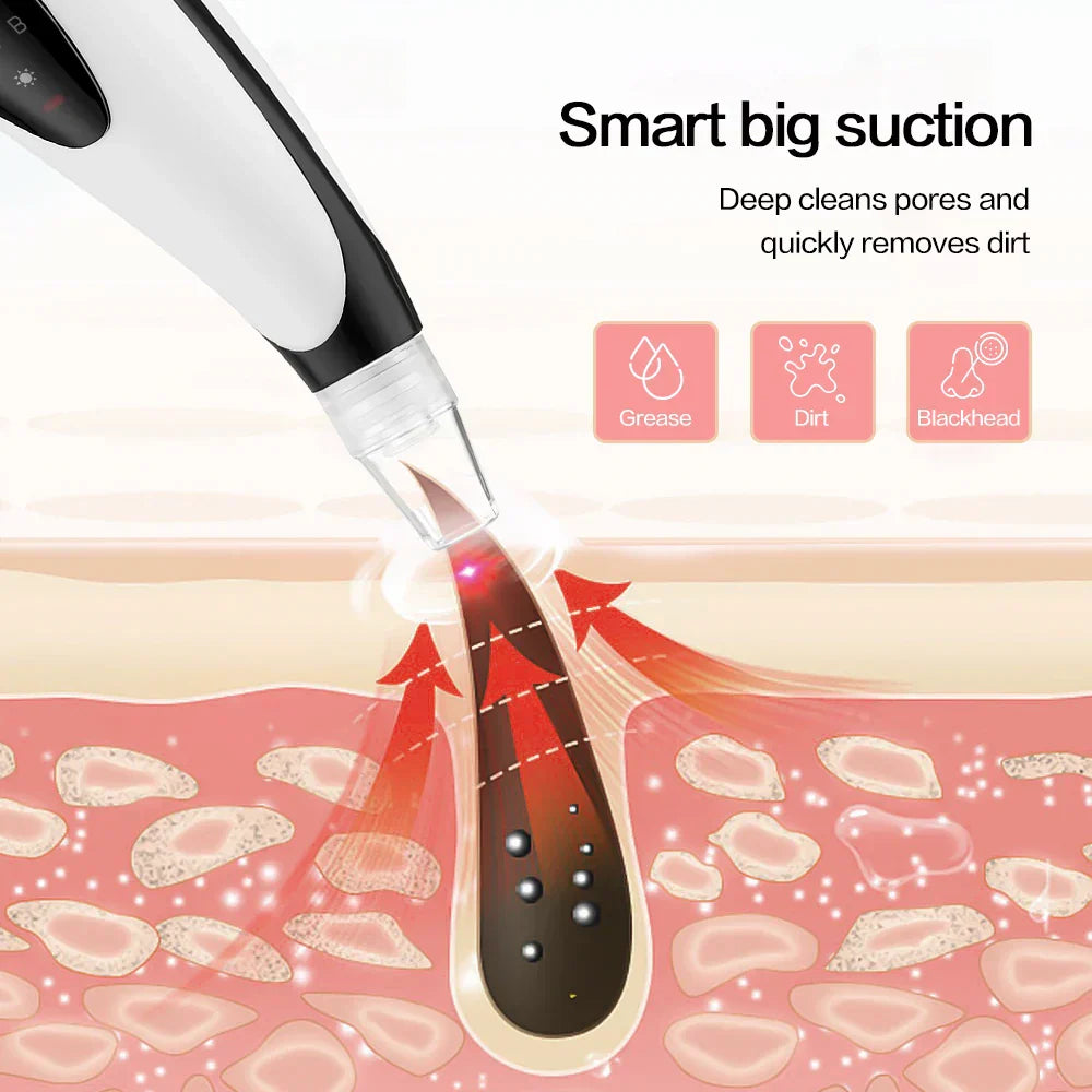 Vacuum Pore Cleaner Electric Blackhead Remover Acne Black