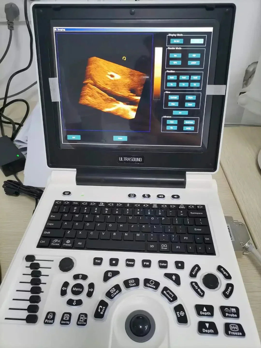 D Based Notebook Black White Ultrasound Scanner Pw