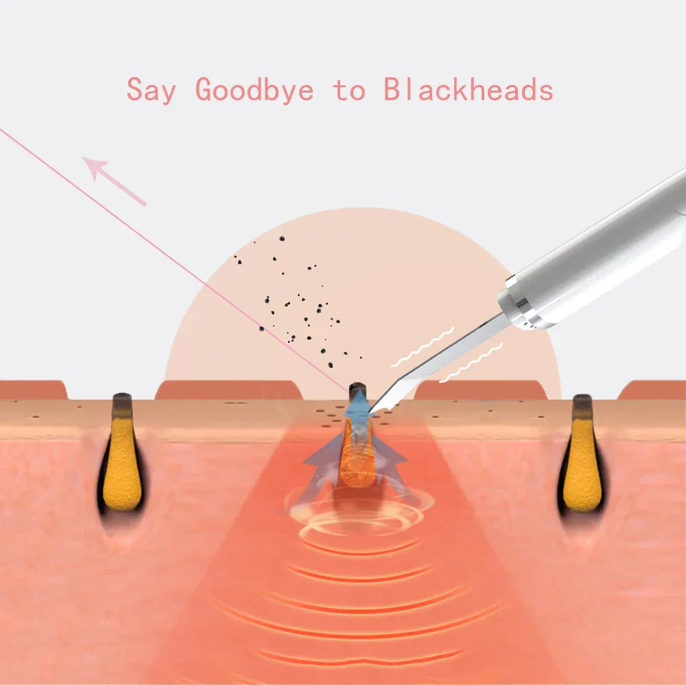 Tewirrow Upgraded Ultrasonic Scrubber Machine Facial Cleanser Skin