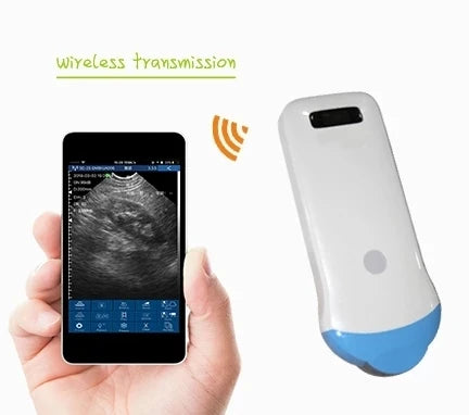 Wireless Ultrasound Probe Scanner Portable Bluetooth Machine Wifi