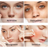 Face Care Sets Turmeric Facial Acne Cleansing Cream