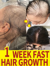 Hair Growth Oil Baldness For Men Treatment