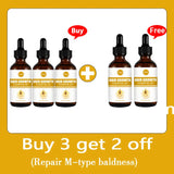 Hair Growth Oil Baldness For Men Treatment