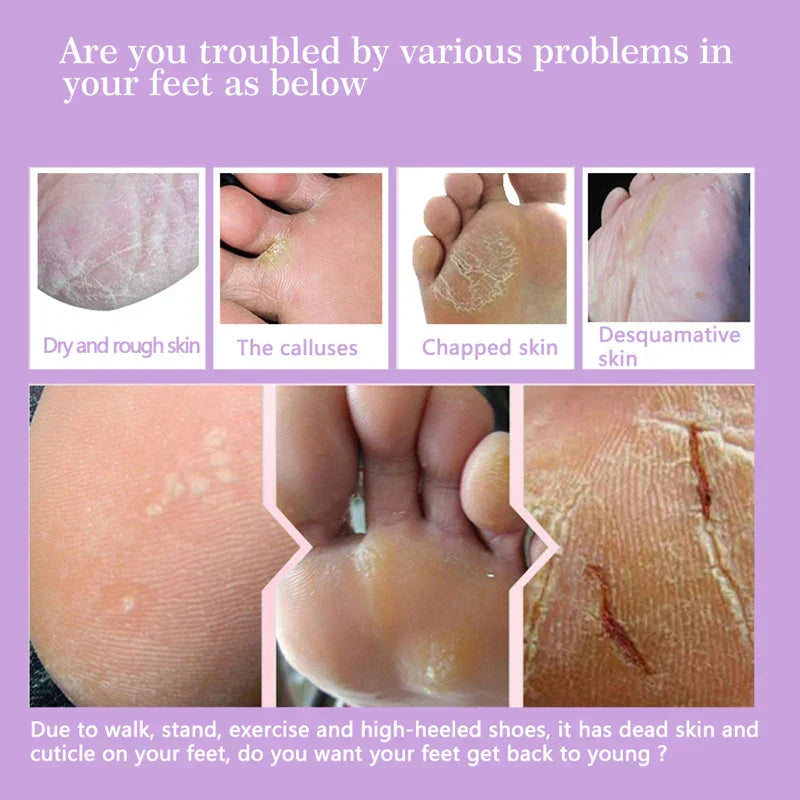 Pair Baby Exfoliating Foot Mask Skin Peeling Dead