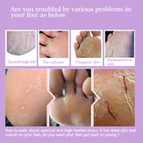 Pair Baby Exfoliating Foot Mask Skin Peeling Dead