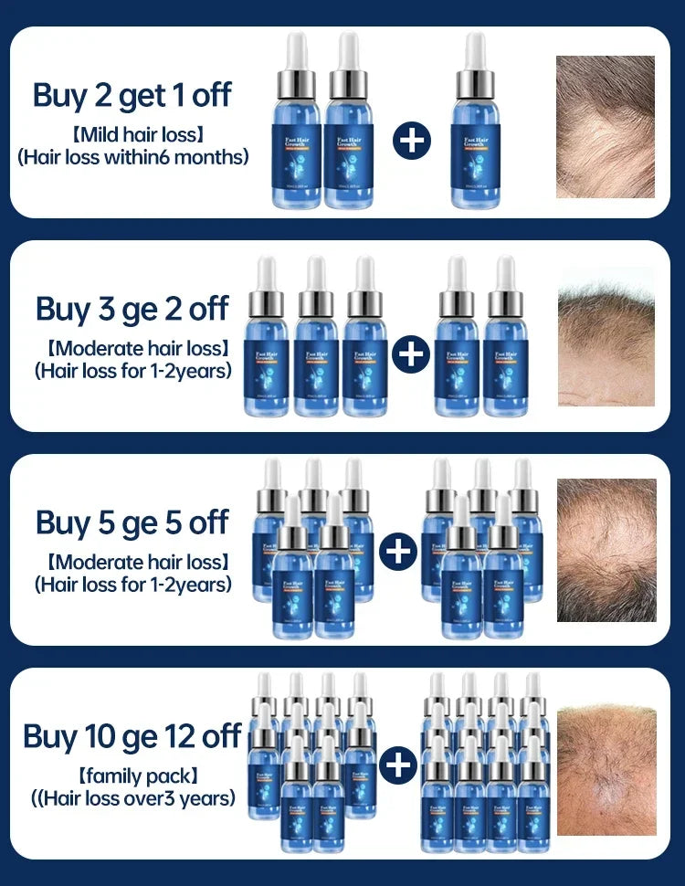 Hair Growth For Men Women Ginger Natural Grow