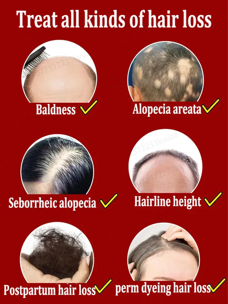 Hair Growth Essential Oil. Effectively Repair Baldness And