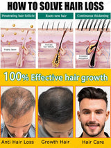 Hair Growth Essential Oil. Effectively Repair Baldness And