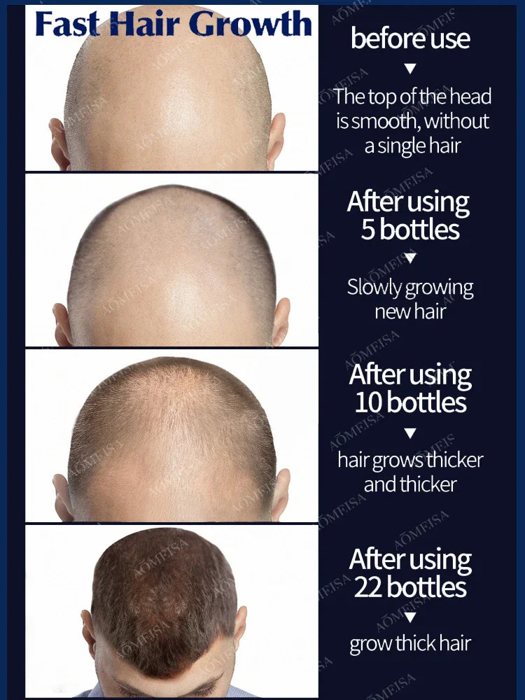 Hair Growth Essential Oil. Effectively Repair Baldness And