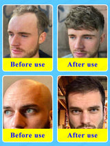 Hair Growth Oil,Effective Baldness Repair, Hereditary Hair Loss,