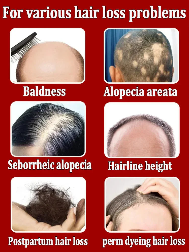 Hair Growth Oil,Effective Baldness Repair, Hereditary Hair Loss,