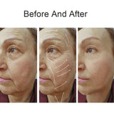 New Radio Frequency Machine Rf Facial Beauty Device