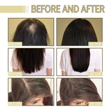 Natural Hair Growth Oil Efficient Anti Hair Loss