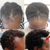 New Fast Hair Growth Serum % African Crazy