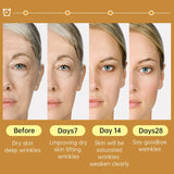 Niacinamide Serum Hyaluronic Acid For Face Dark Spot