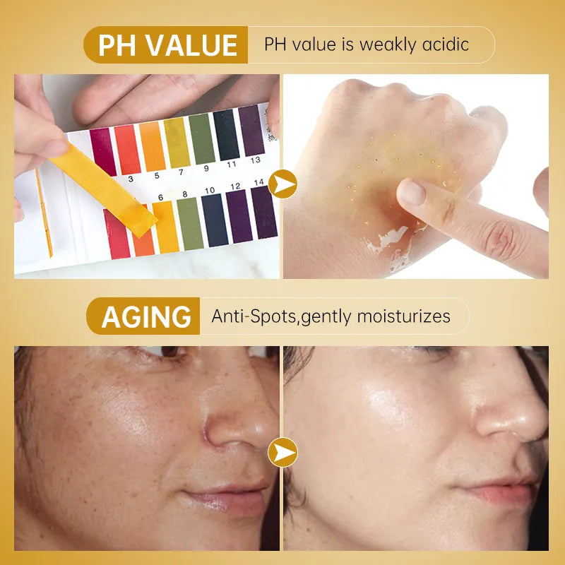 Niacinamide Serum Hyaluronic Acid For Face Dark Spot
