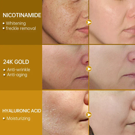 Niacinamide Serum Hyaluronic Acid For Face Dark Spot