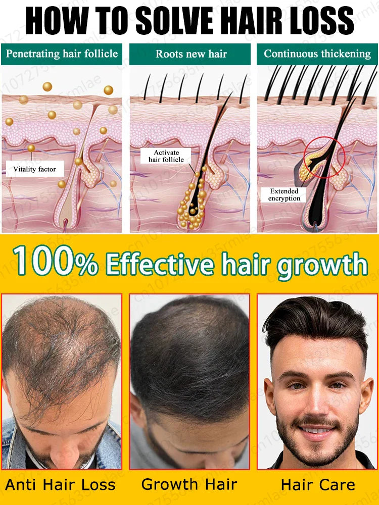 Oil Hair Growth Products For Man Women Ginger