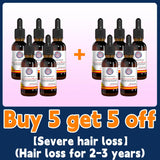 Oil Hair Growth Products For Man Women Ginger