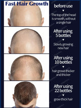 Oil Hair Growth Products For Man Women Ginger