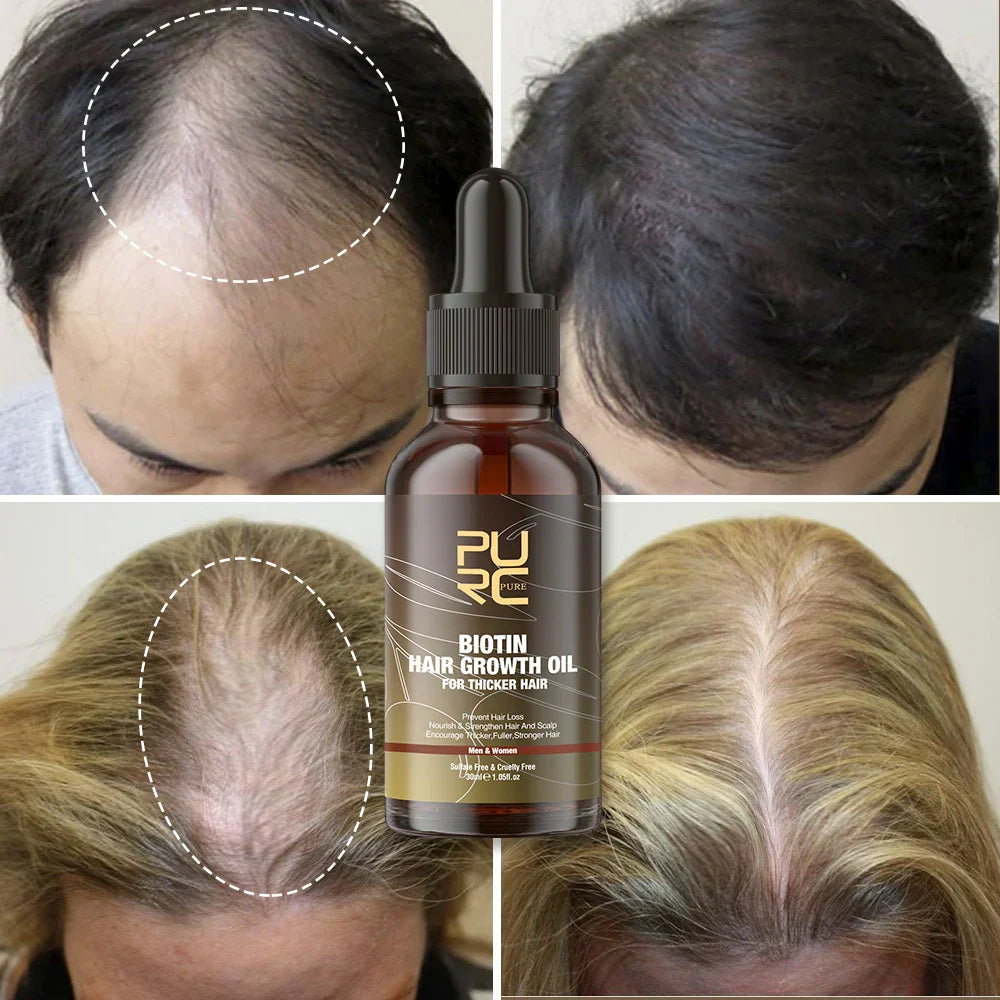 Purc Fast Hair Growth Products For Men Biotin