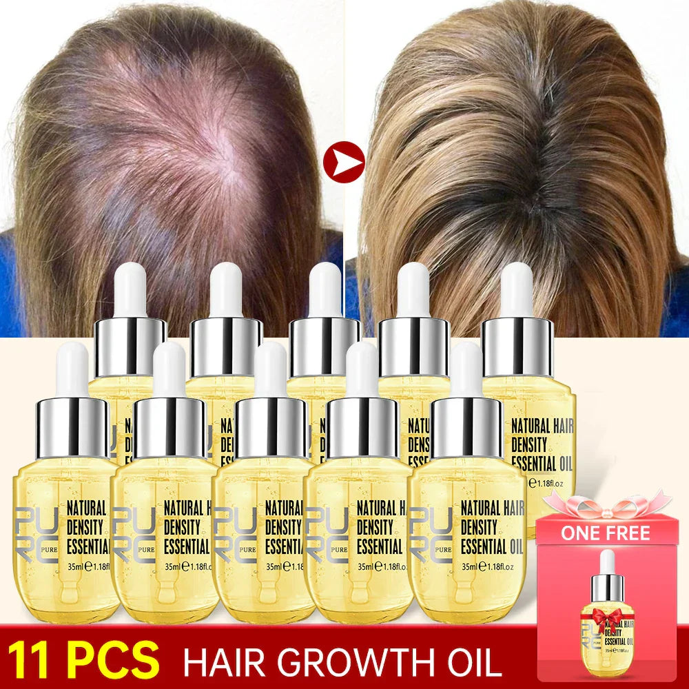 Purc Hair Growth For Men Women Products Ginger