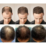 Ginger Hair Growth Soap Anti Hair Loss Fast