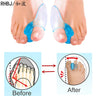 Silicone Gel Thumb Corrector Bunion Foot Toe Hallux