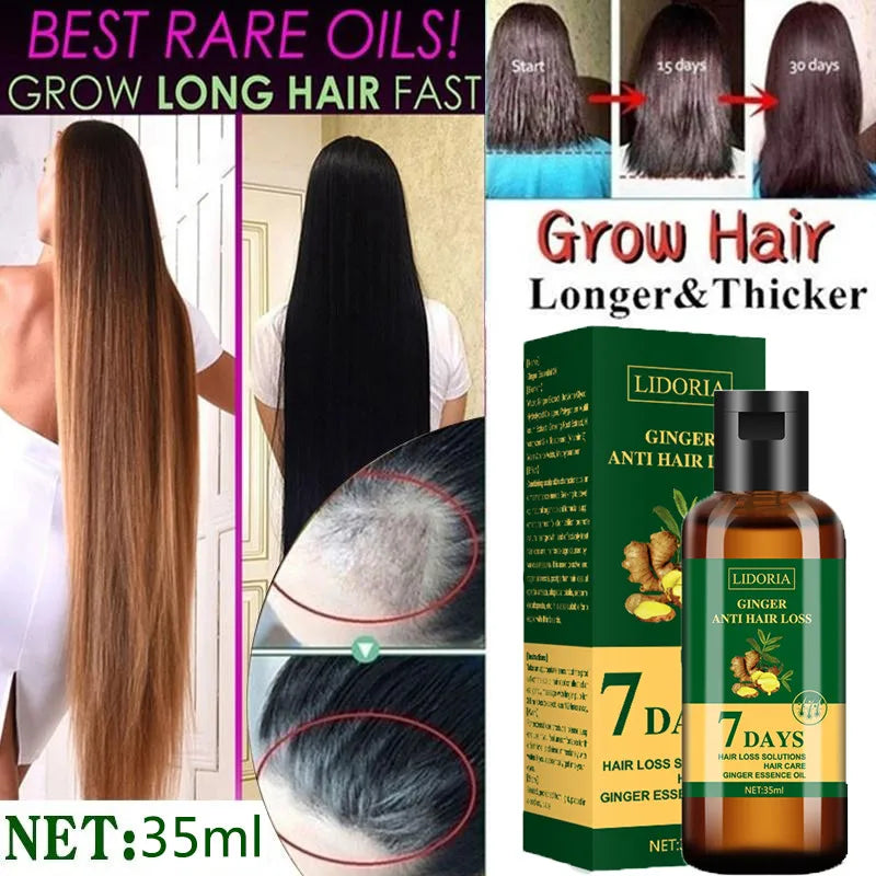 Ginger Hair Growth Product Anti-Loss Hair Regrowth Serum