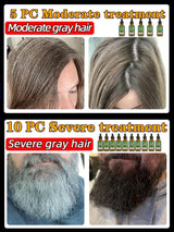 Gray Hair Treatment Serum White To Black Natural