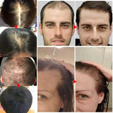 Ginger Hair Growth Essential Oil Anti-Loss Hair Regrowth