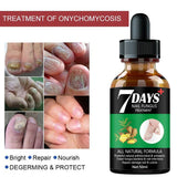 Days Repair Nail Fungus Treatments Essence Foot Care