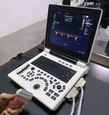 D Based Notebook Black White Ultrasound Scanner Pw