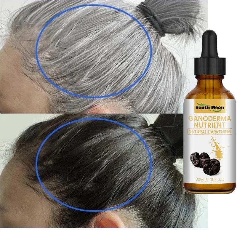 Gray White Hair Treatment Serum Oil White