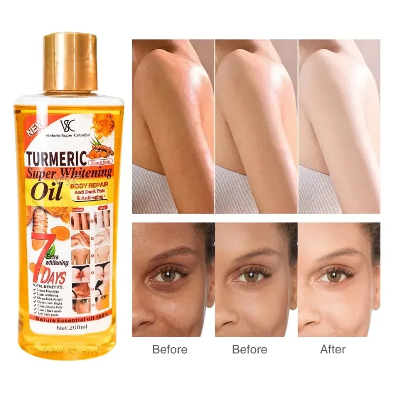 Turmeric Essential Oil With For Skin Massage, Body