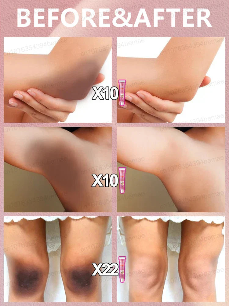 Whitening Cream Private Parts Underarm Bleaching Serum Whiten