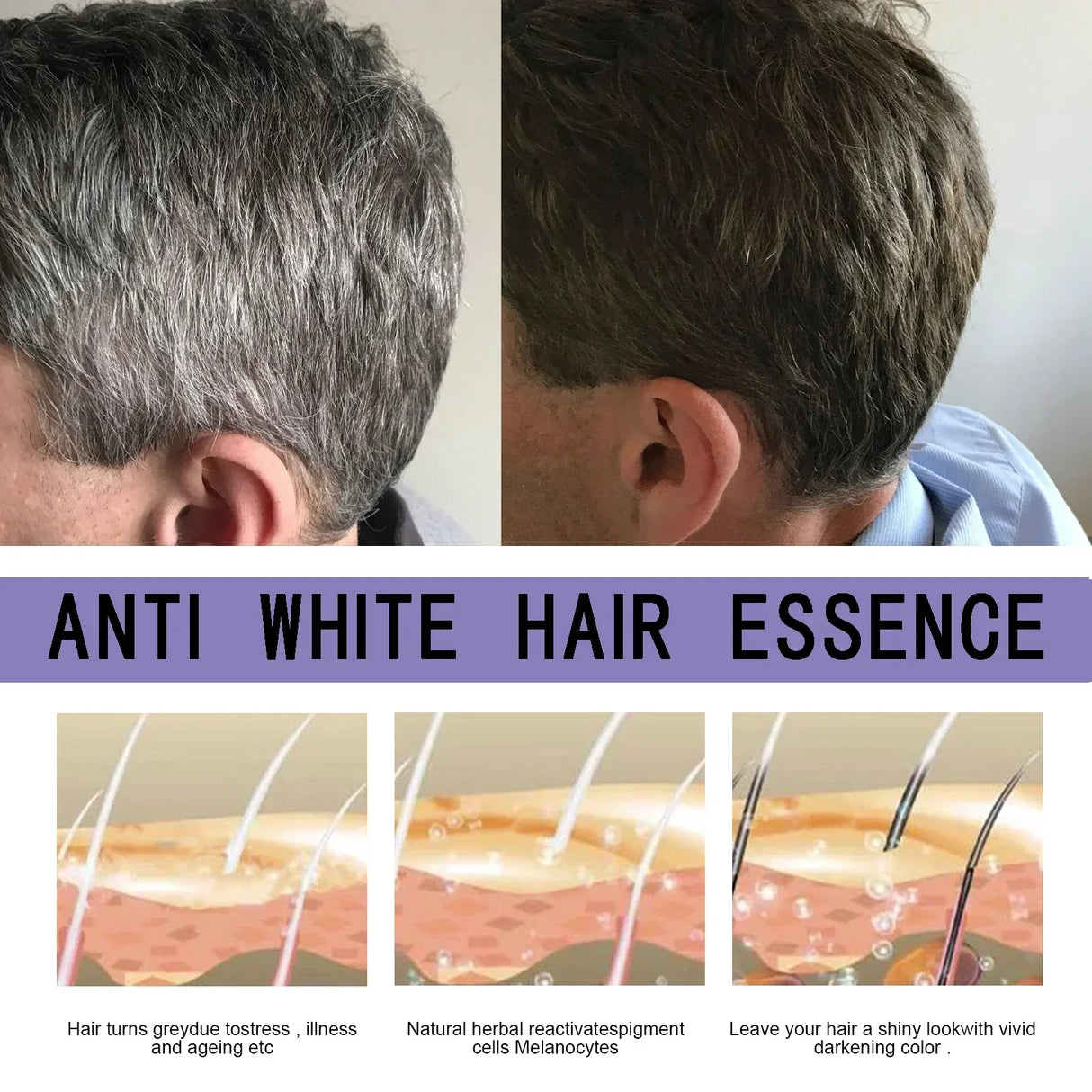Serum Perawatan Rambut Abu-Abu Produk Nutrisi Perbaikan Warna
