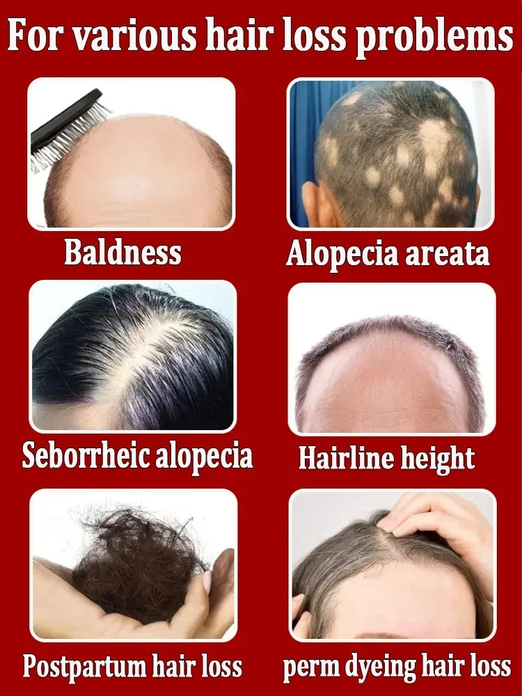 Hair Growth Essence Can Quickly Grow Hair