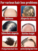 Hair Growth Essence Can Quickly Grow Hair