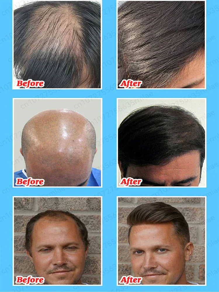 Hair Growth Essence Can Quickly Grow Hair