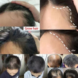 Ginger Hair Growth Spray Promote Fast Thicker Longer