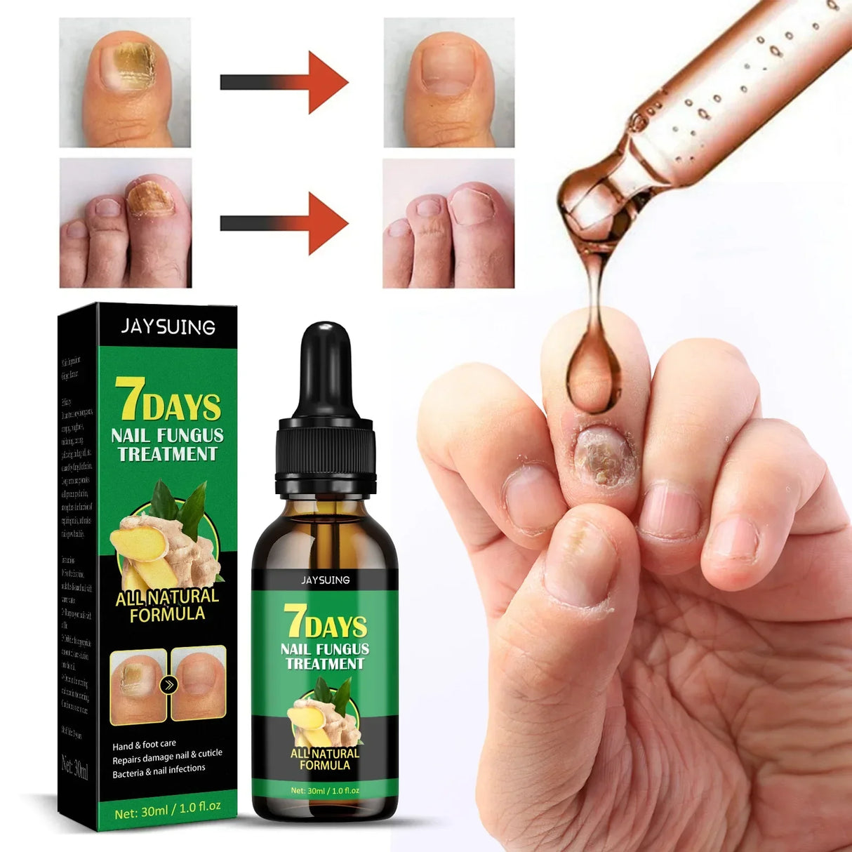 Days Repair Nail Fungus Treatments Essence Foot Care
