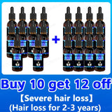 Hair Growth Essence Can Quickly Grow Hair