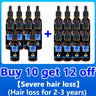 Hair Growth Essence Can Quickly Grow Hair