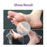 Foot Mask Exfoliating Anti Drying Cracking Heel Peeling