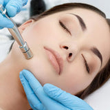 Diamond Microdermabrasion Machine